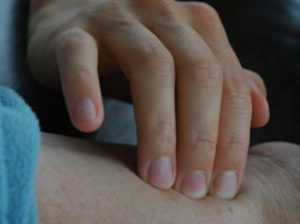 Treatments